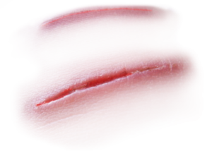 Scar PNG-15751